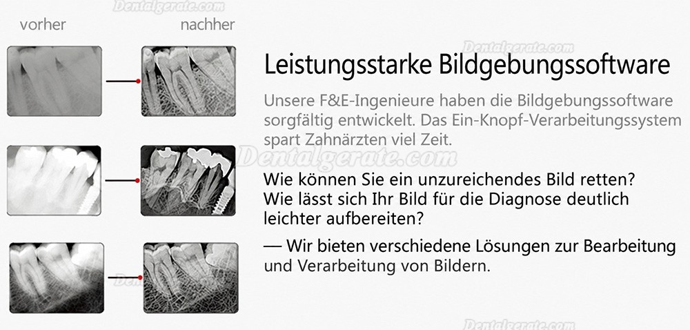 Handy HDR-600A Digitaler Intraorale R&ouml;ntgensensor Zahn&auml;rztlich Intraorale Flachkollektoren